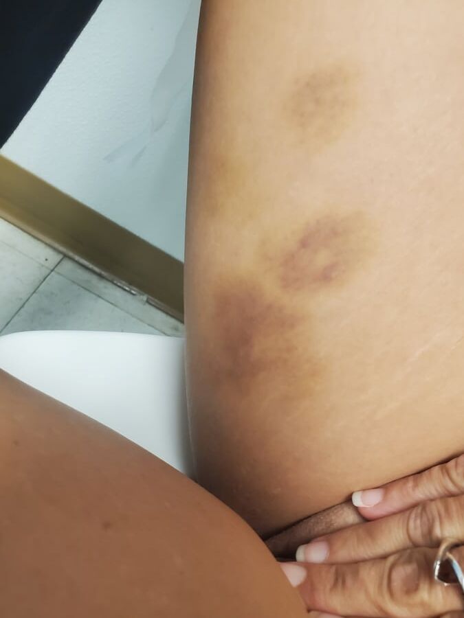 Bondage fun