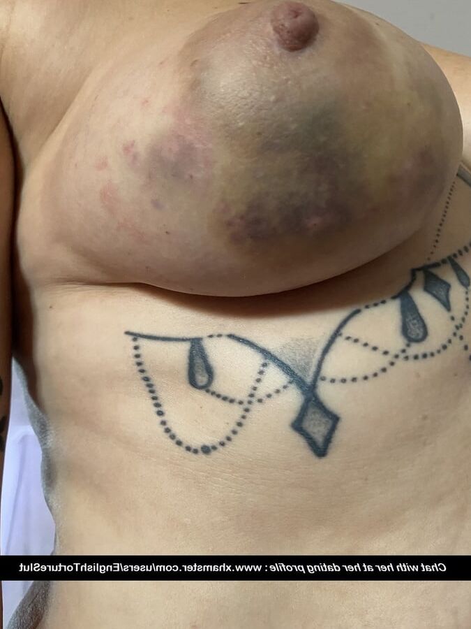 Tit Torture