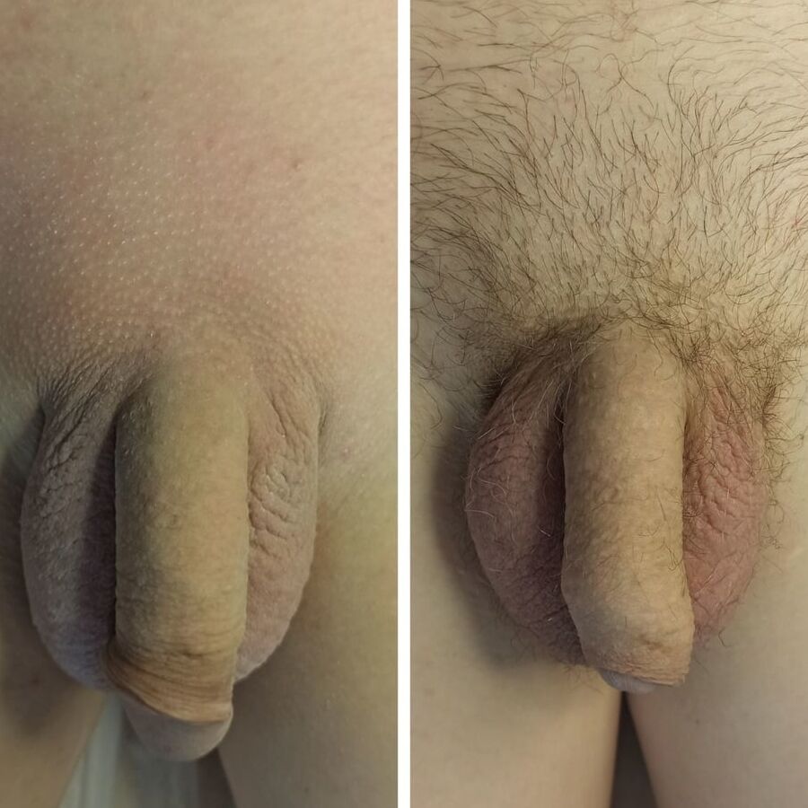 Look! After my procedure, all the dicks really got bigger!