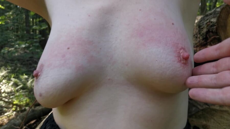 Tit slapping red for fun while hiking