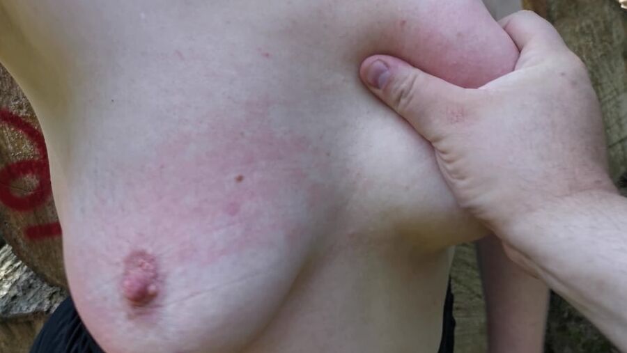 Tit slapping red for fun while hiking