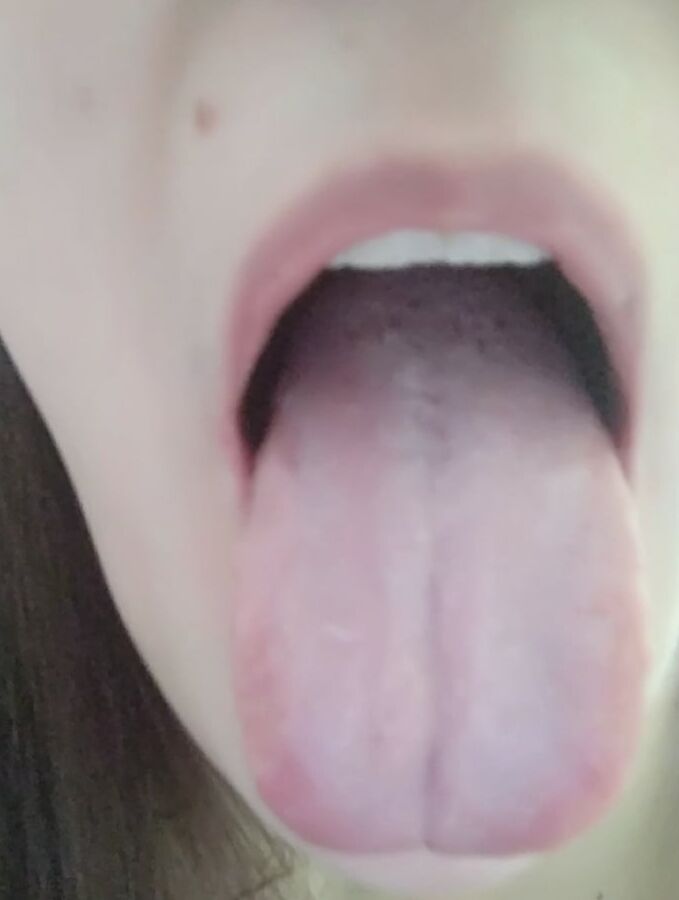 Mouth
