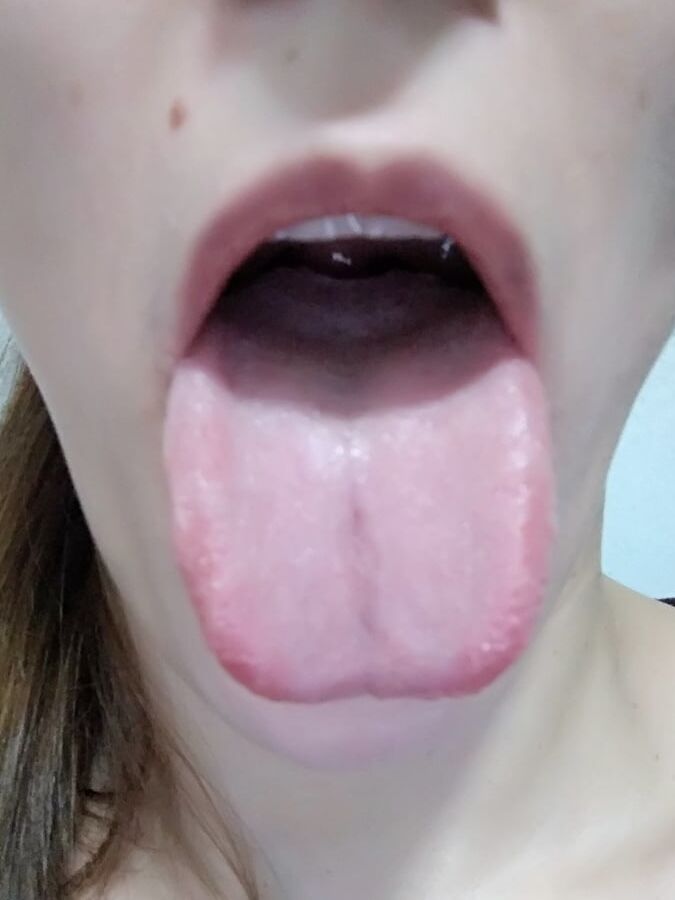 Mouth