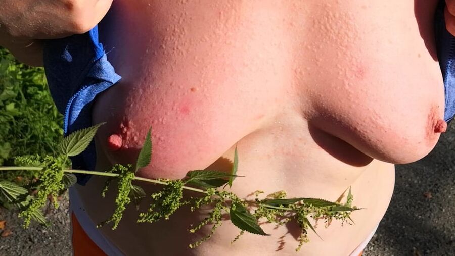 Put some nettles in my bra