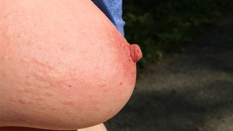 Put some nettles in my bra