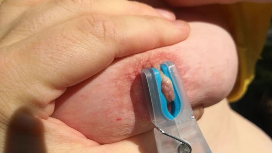 Clamps an slapping tits in public place