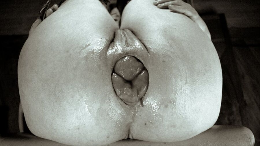 EXTREME PROLAPSE FETISH