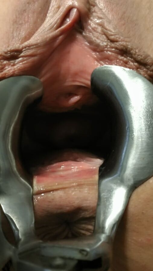 Speculum, sounding and urethra jewelry