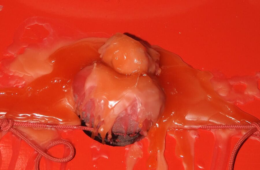 Hot Wax