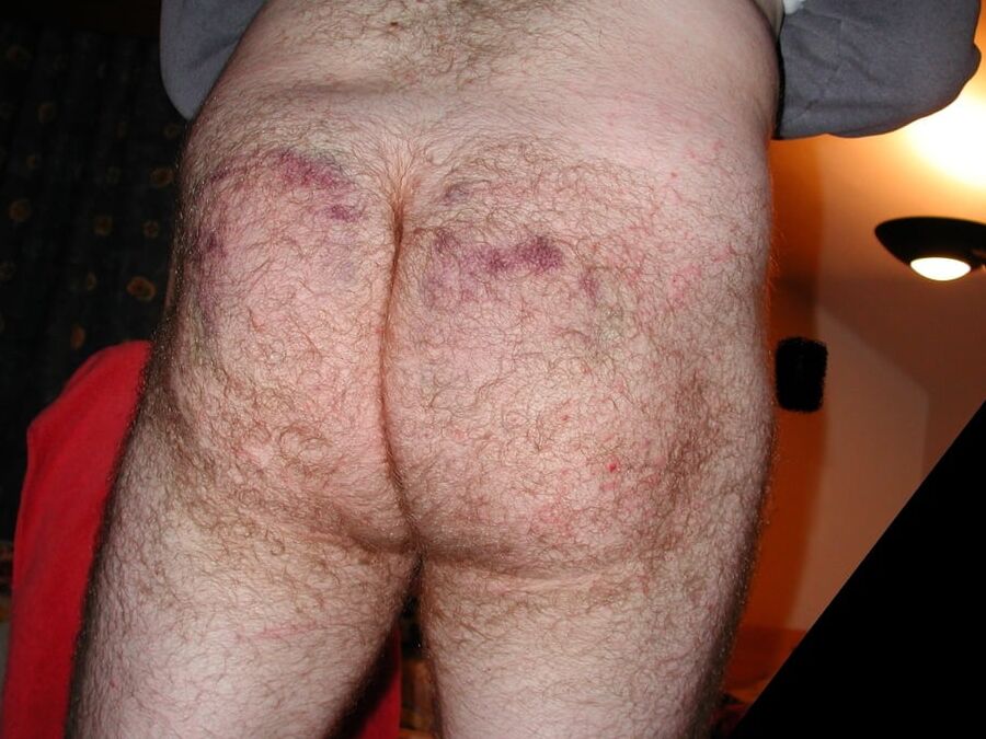 Caning