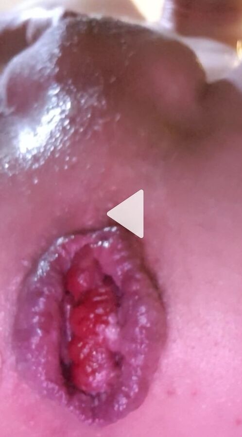 My  anal-Toys