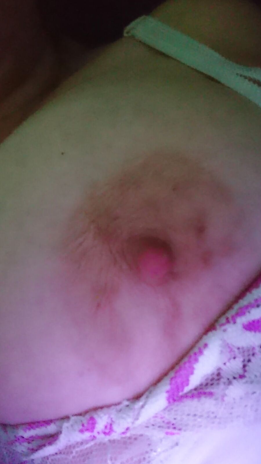 Nipples