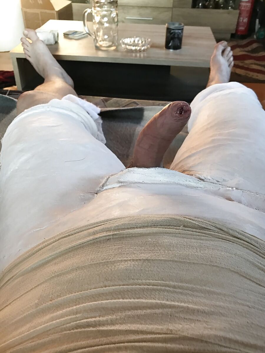 Bodycast