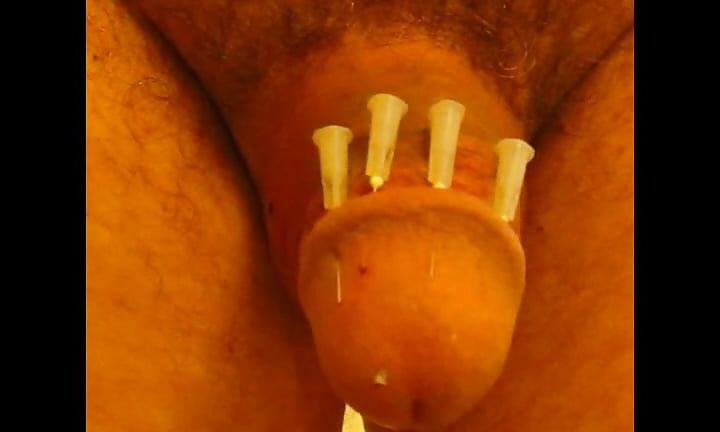Nadeln 4