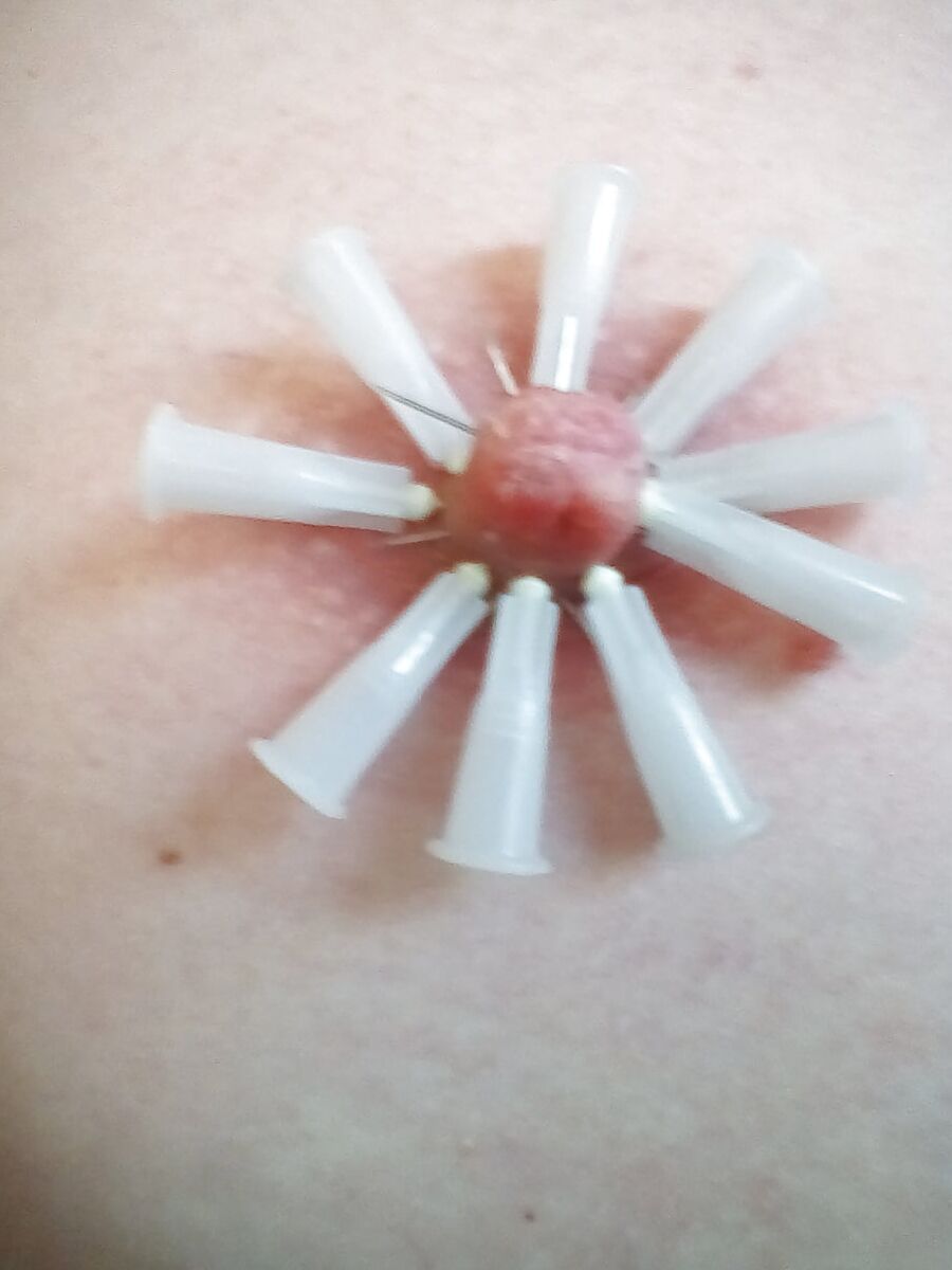 Nadeln 3