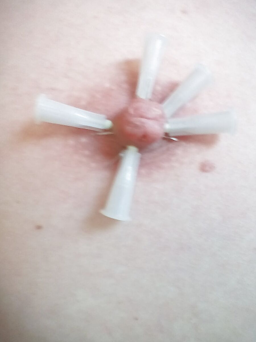 Nadeln 3
