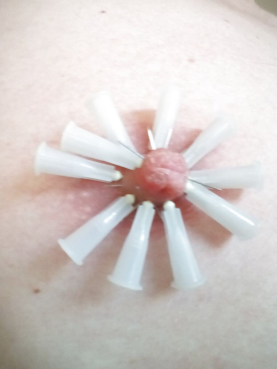 Nadeln 3