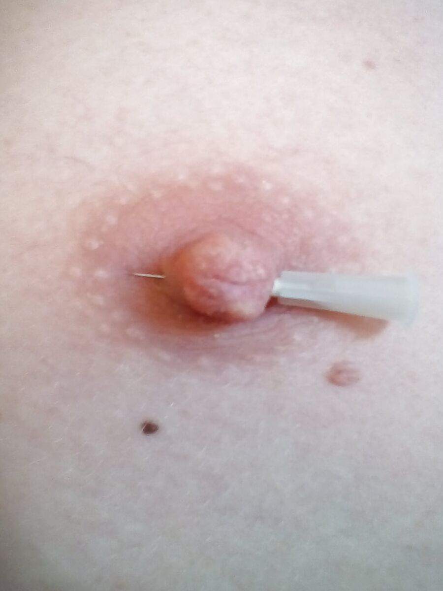 Nadeln 3