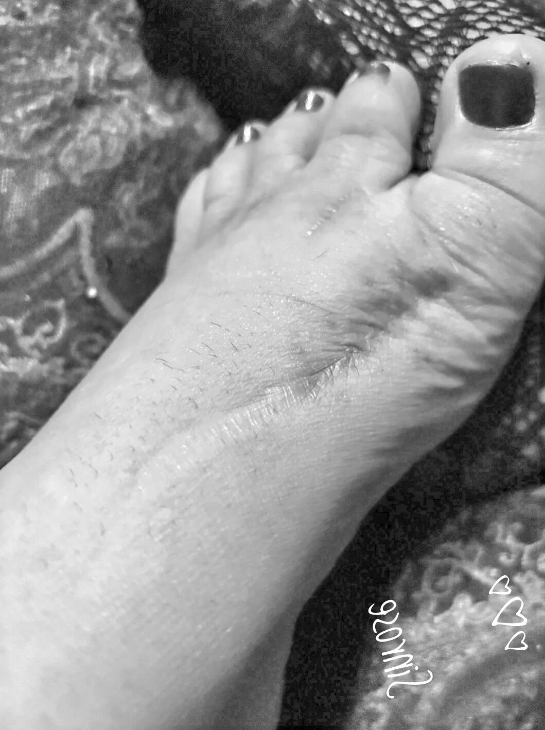Injured foot needs healing .. still sexy