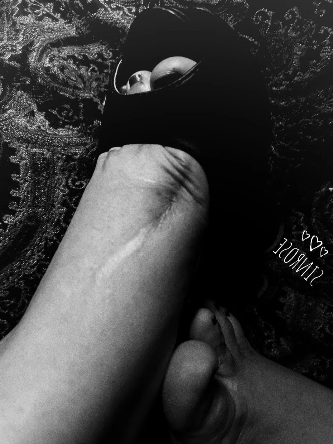 Injured foot needs healing .. still sexy
