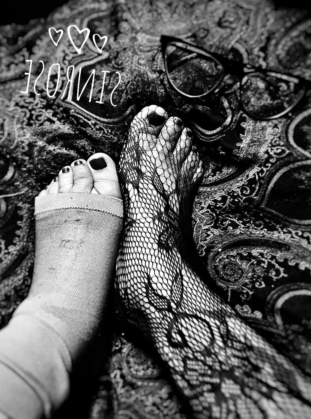 Injured foot needs healing .. still sexy