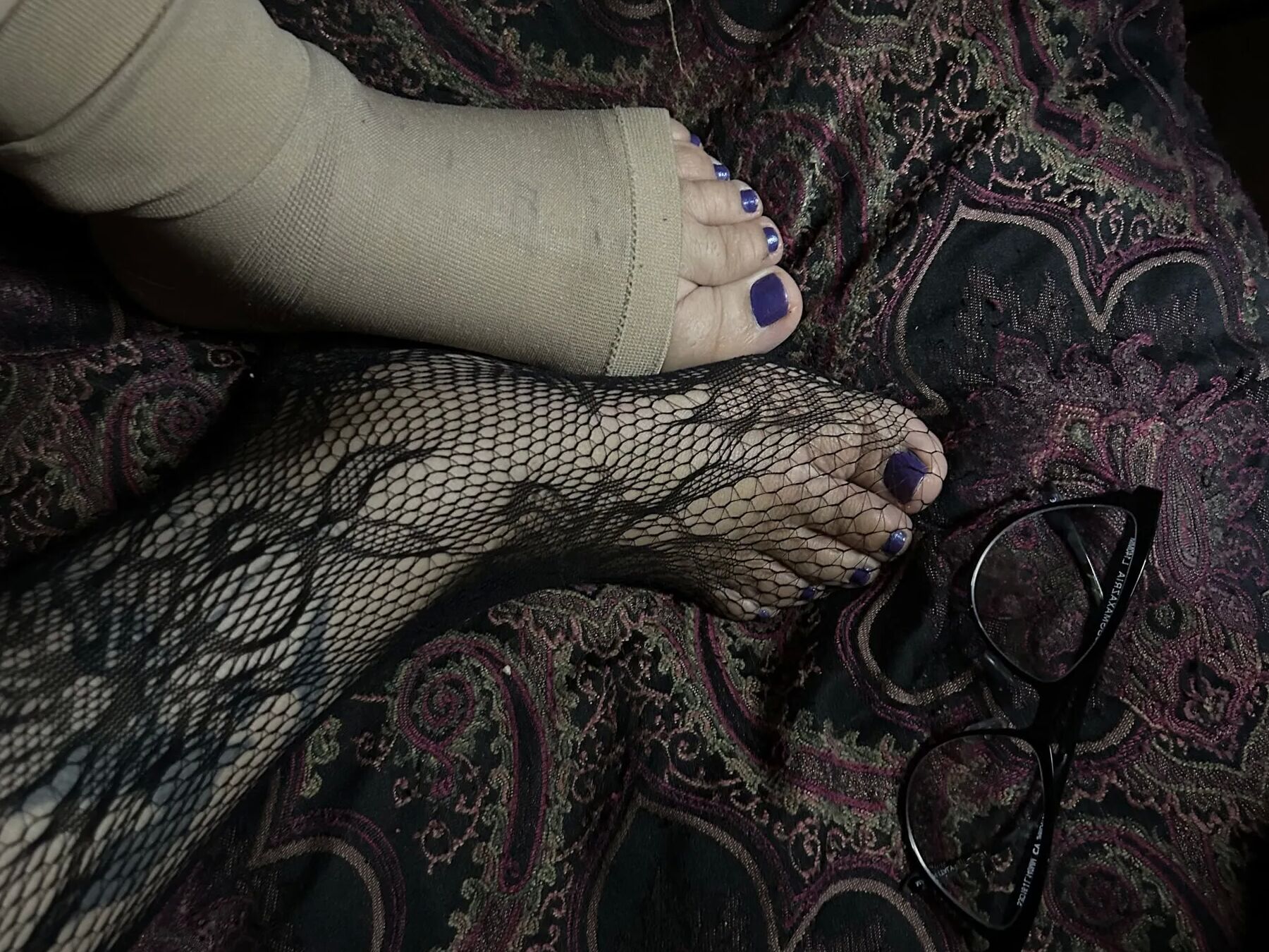 Injured foot needs healing .. still sexy