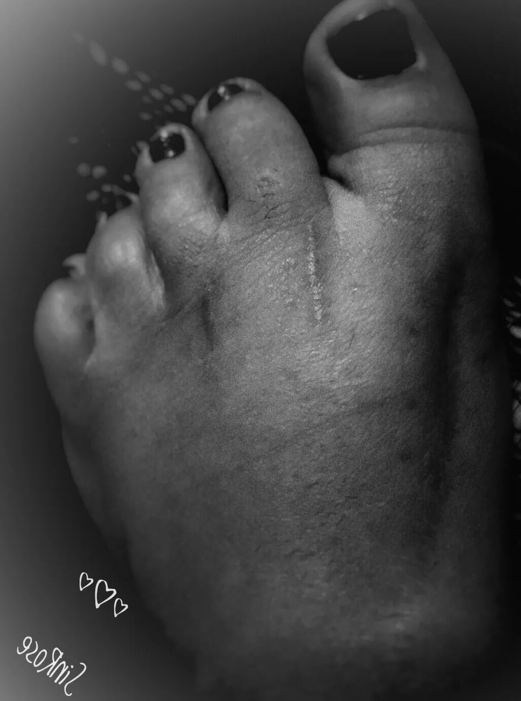 Injured foot needs healing .. still sexy