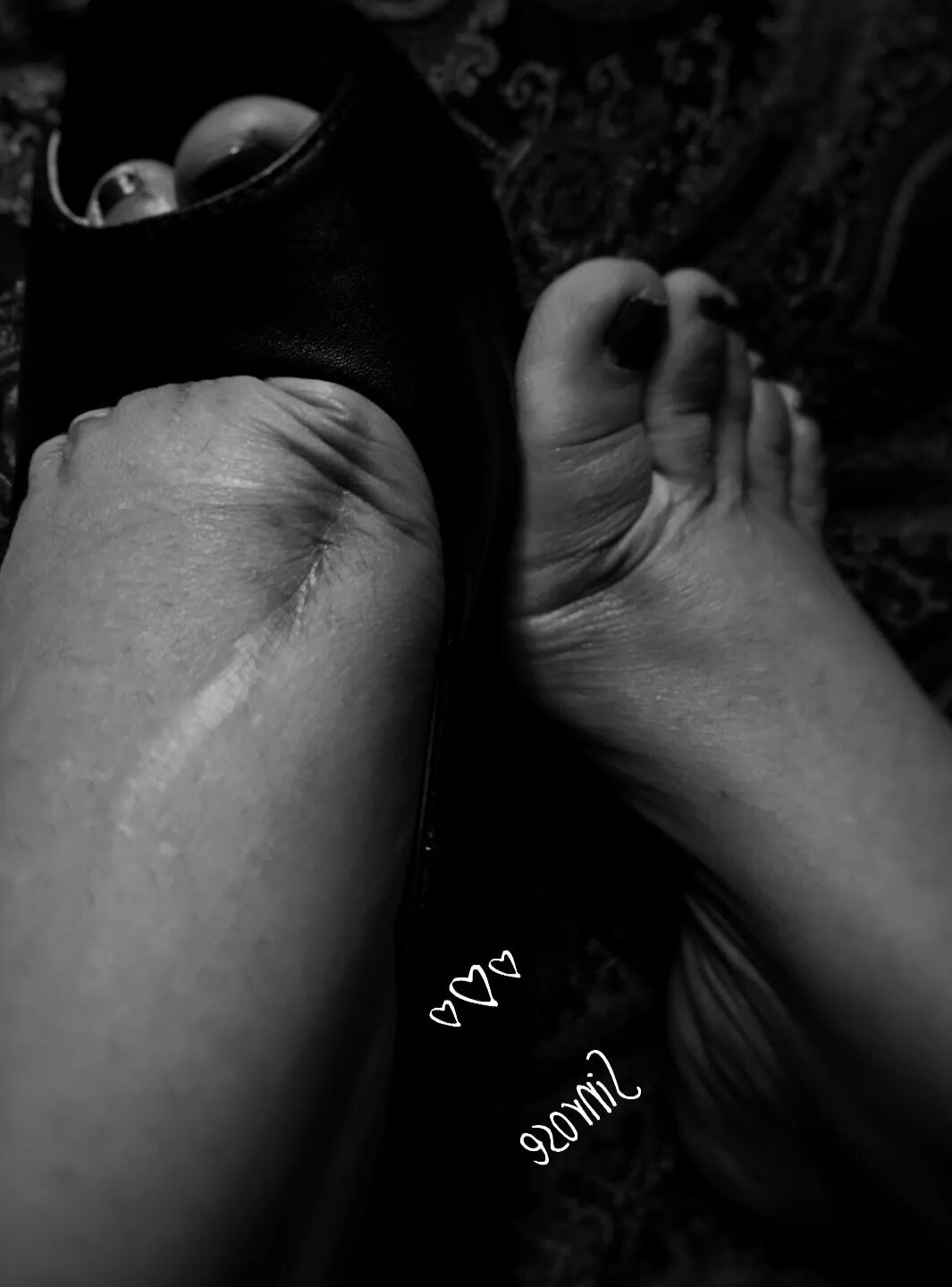 Injured foot needs healing .. still sexy