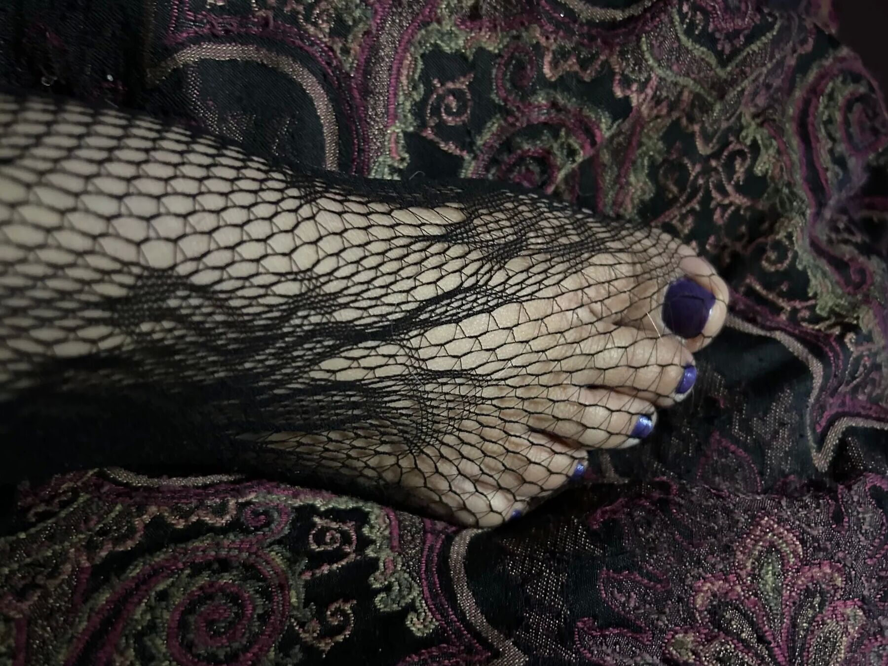 Injured foot needs healing .. still sexy
