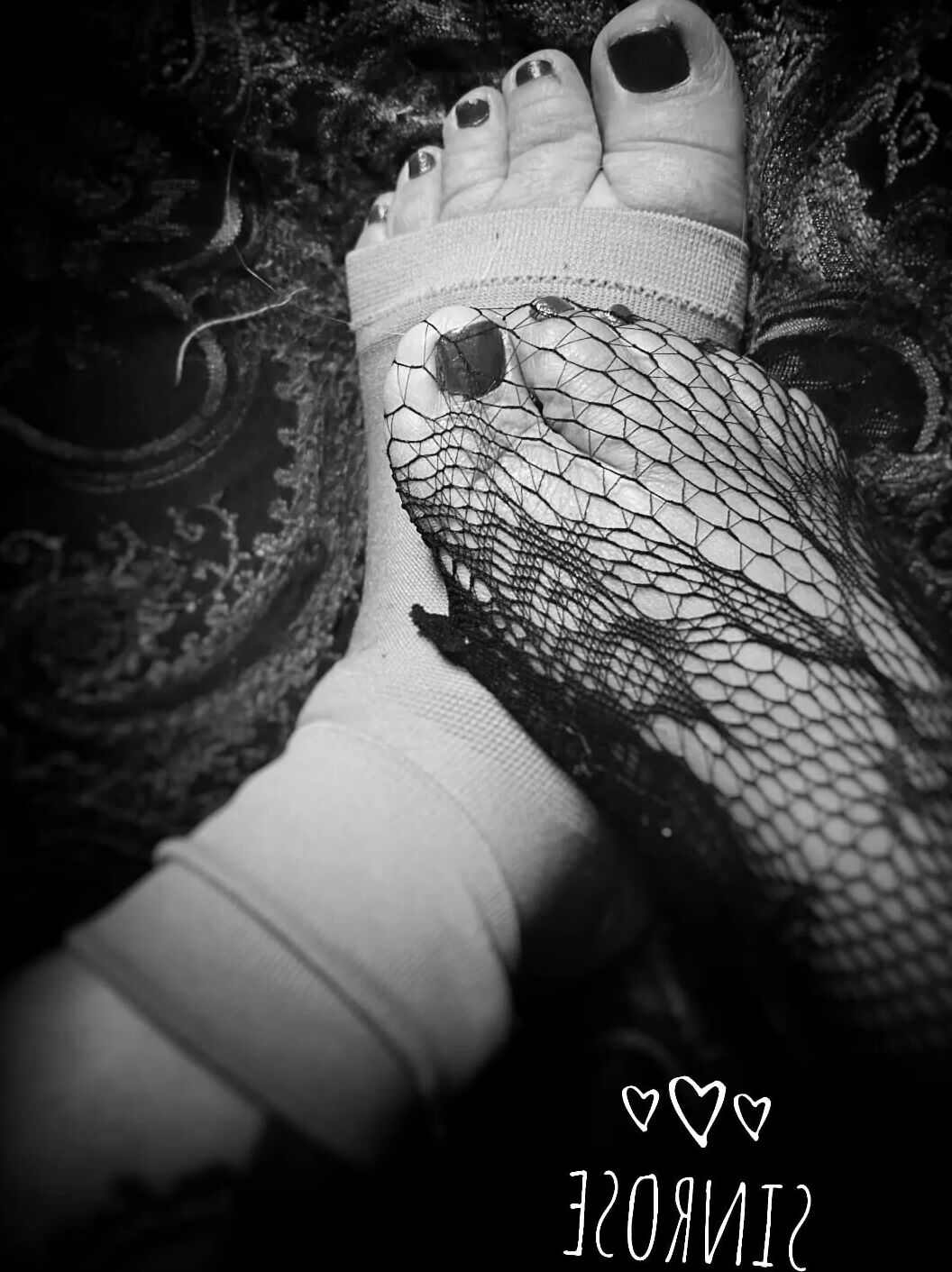 Injured foot needs healing .. still sexy