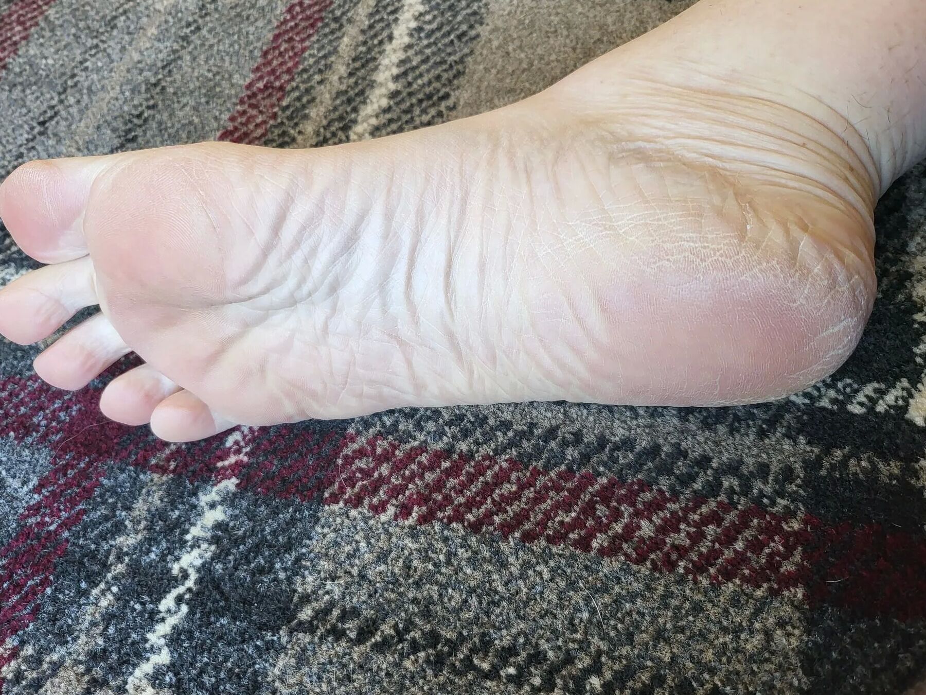 Merry Merida's unloved feet  Free Photos