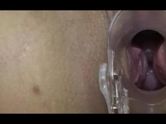 Deep inside Anna