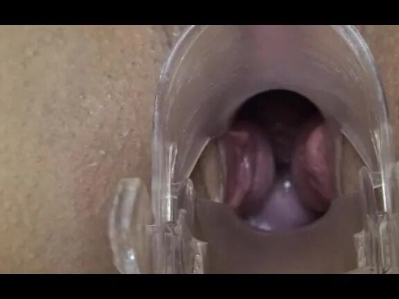 Deep inside Anna
