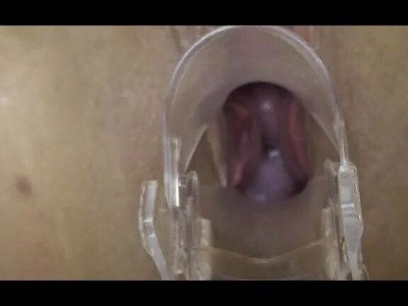 Deep inside Anna