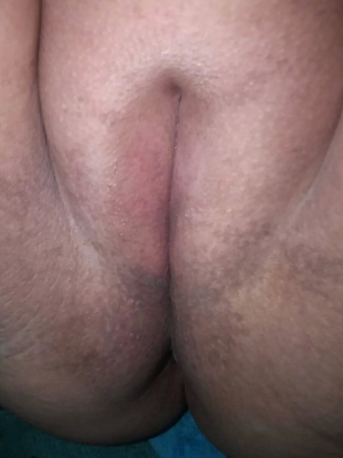 Fat Slut Melanie Big Tits Out