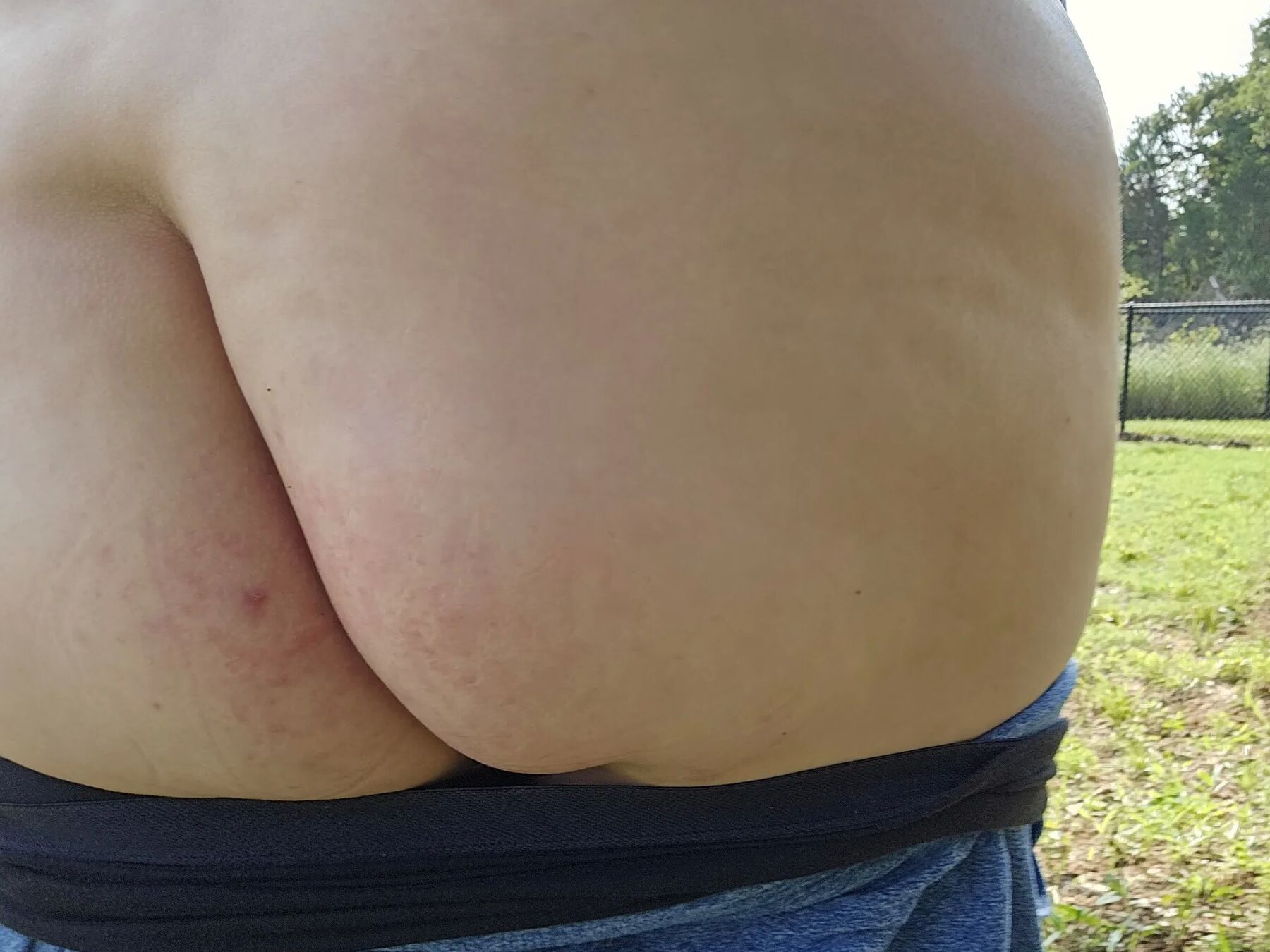 Flashing at the dog park #2