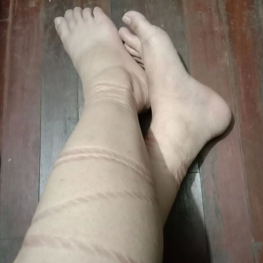 Rope marks