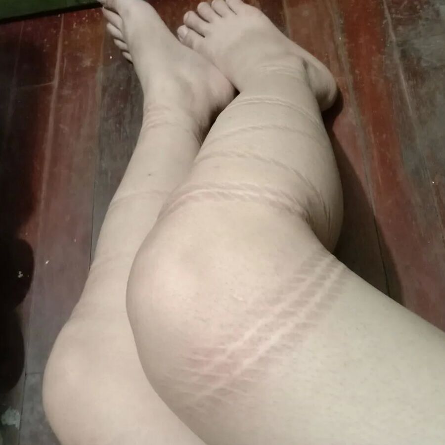Rope marks