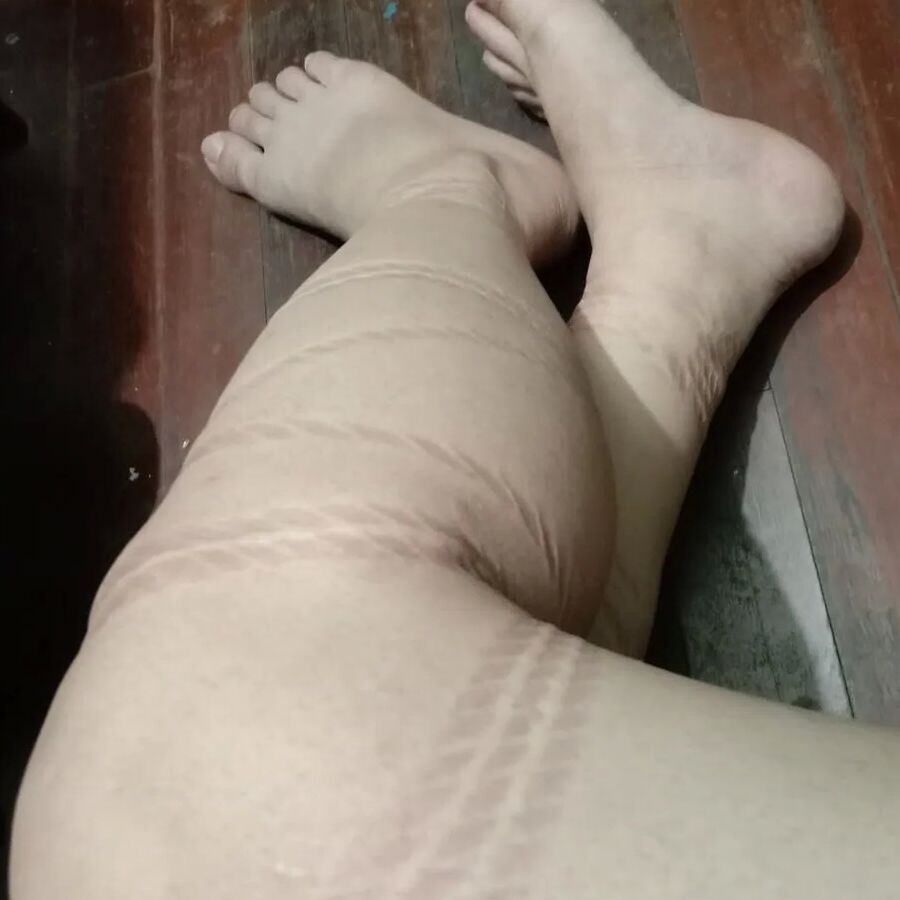 Rope marks