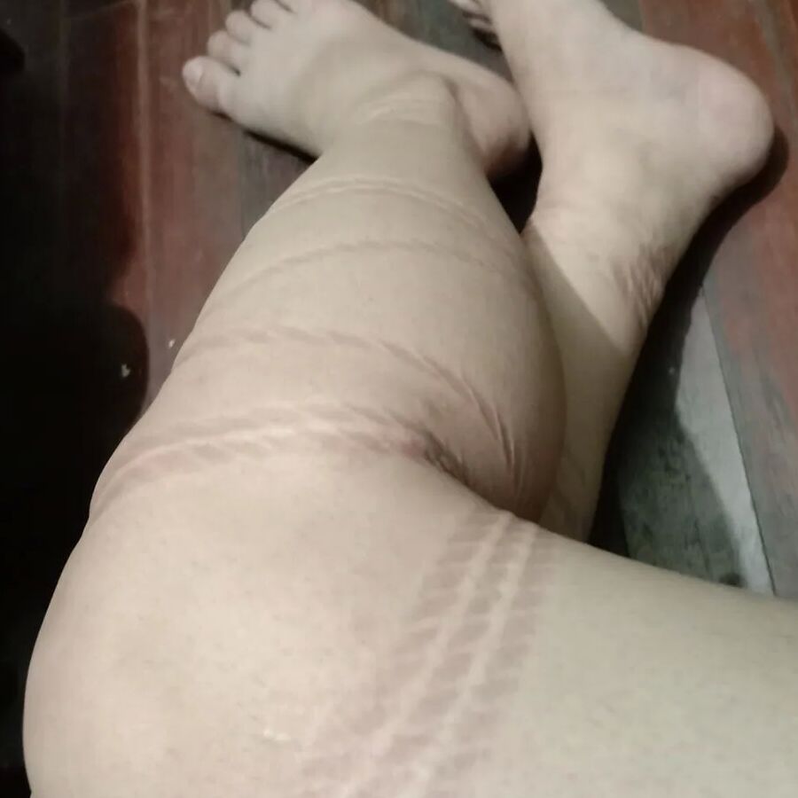 Rope marks
