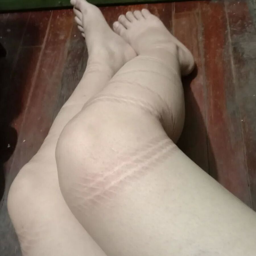 Rope marks