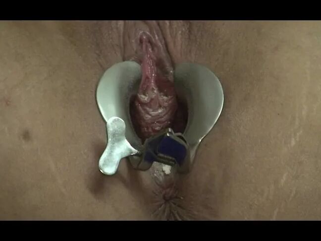 Penalty - Tied and with speculum