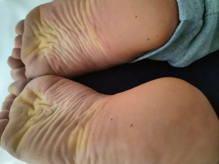 Hornychubby feet soles wrinkled Barefoot