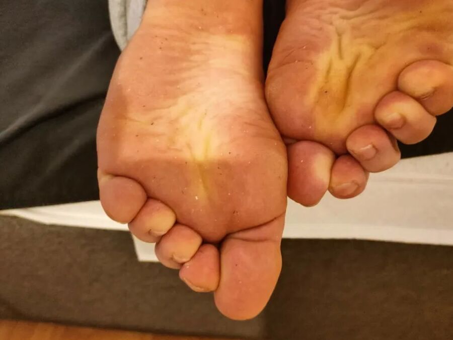 Hornychubby feet soles wrinkled Barefoot