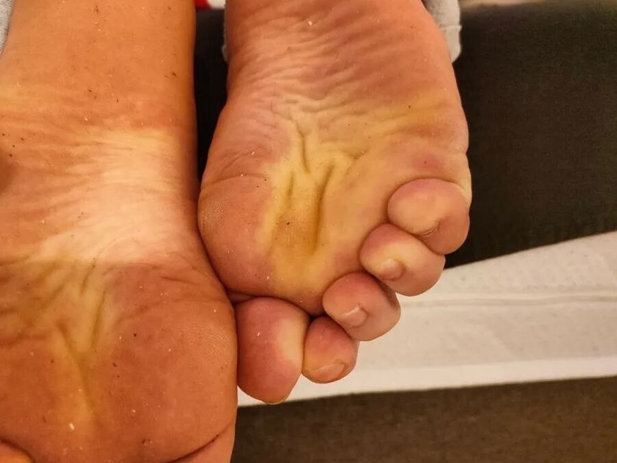 Hornychubby feet soles wrinkled Barefoot