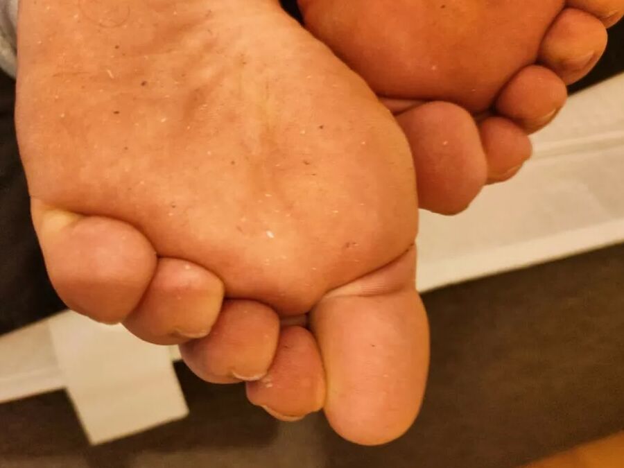 Hornychubby feet soles wrinkled Barefoot
