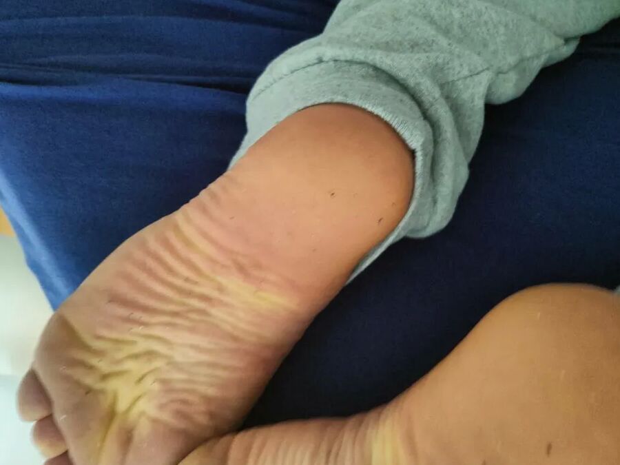 Hornychubby feet soles wrinkled Barefoot