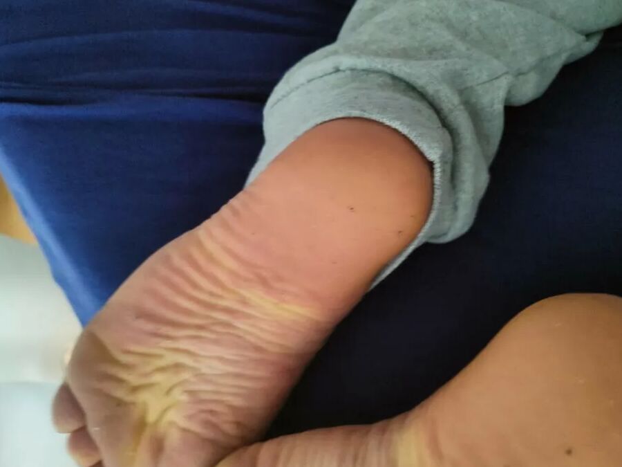 Hornychubby feet soles wrinkled Barefoot