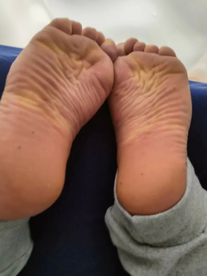 Hornychubby feet soles wrinkled Barefoot