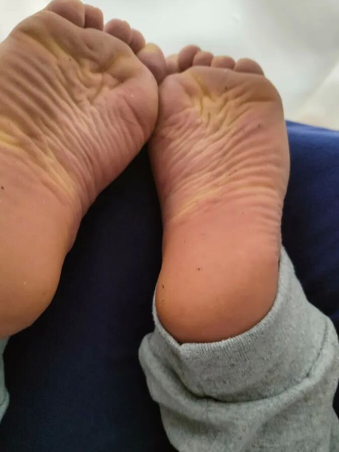 Hornychubby feet soles wrinkled Barefoot